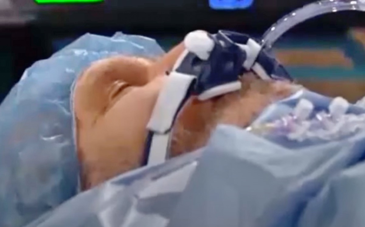 B&B Spoilers Update Friday, December 15: Can Eric Be Saved, Bridget And Finn Struggle, Time Is Runnin Out